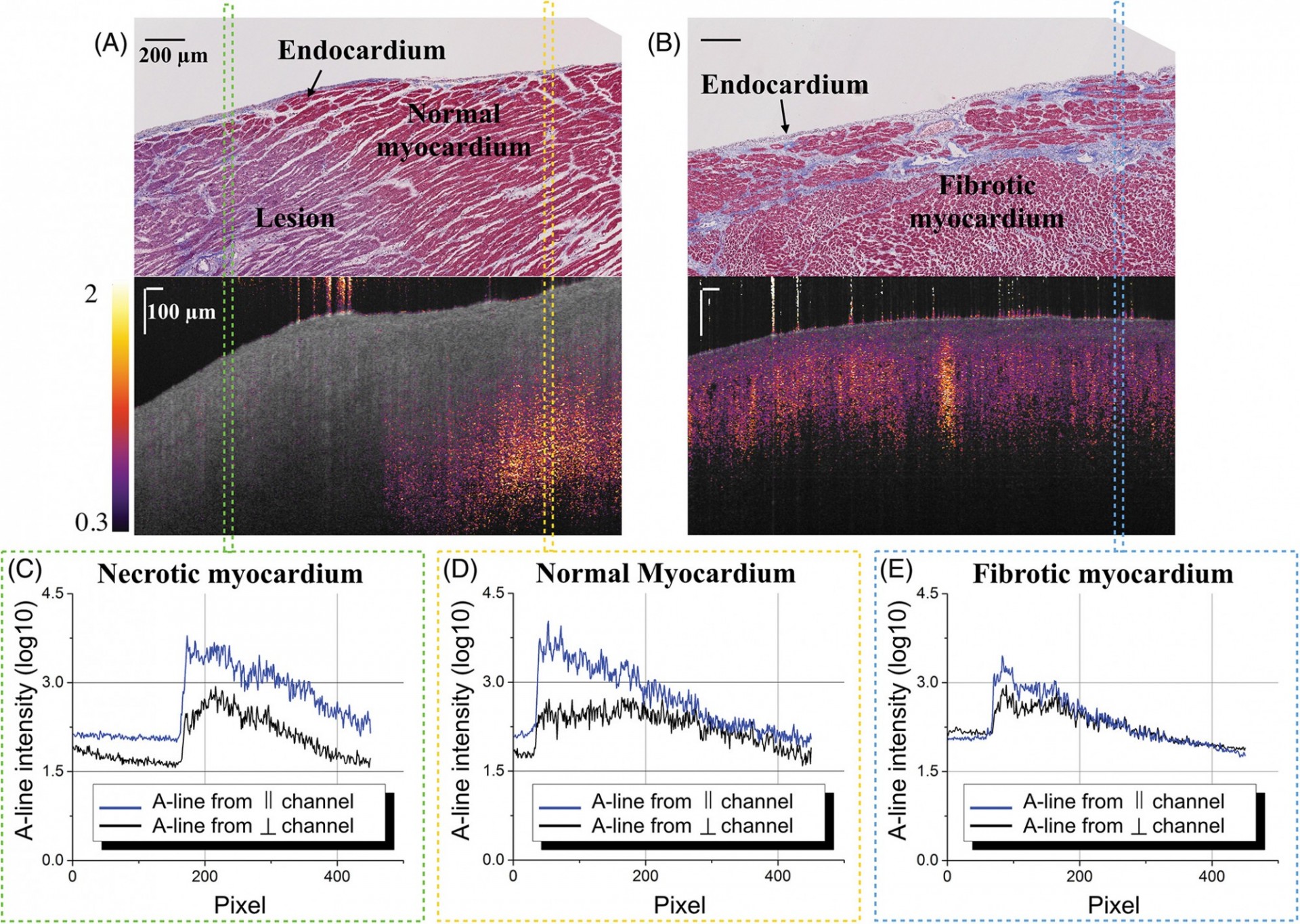 High Resolution Imaging Of The Myocardium | Structure Function Imaging ...