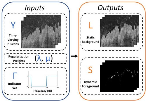 Frequency-Constrained Robust Principle Component Analysis: A Sparse Representations approach to Segmentation of Dynamic Features in Optical Coherence imaging. Optics Express. 25(21). pp. 25819-25830. (2017)