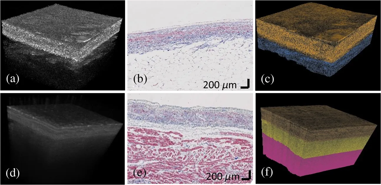 automated classification of OCT images of atrial tissue with machine learning