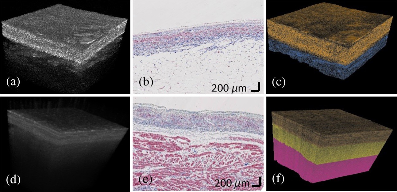 automated classification of OCT images of atrial tissue with machine learning