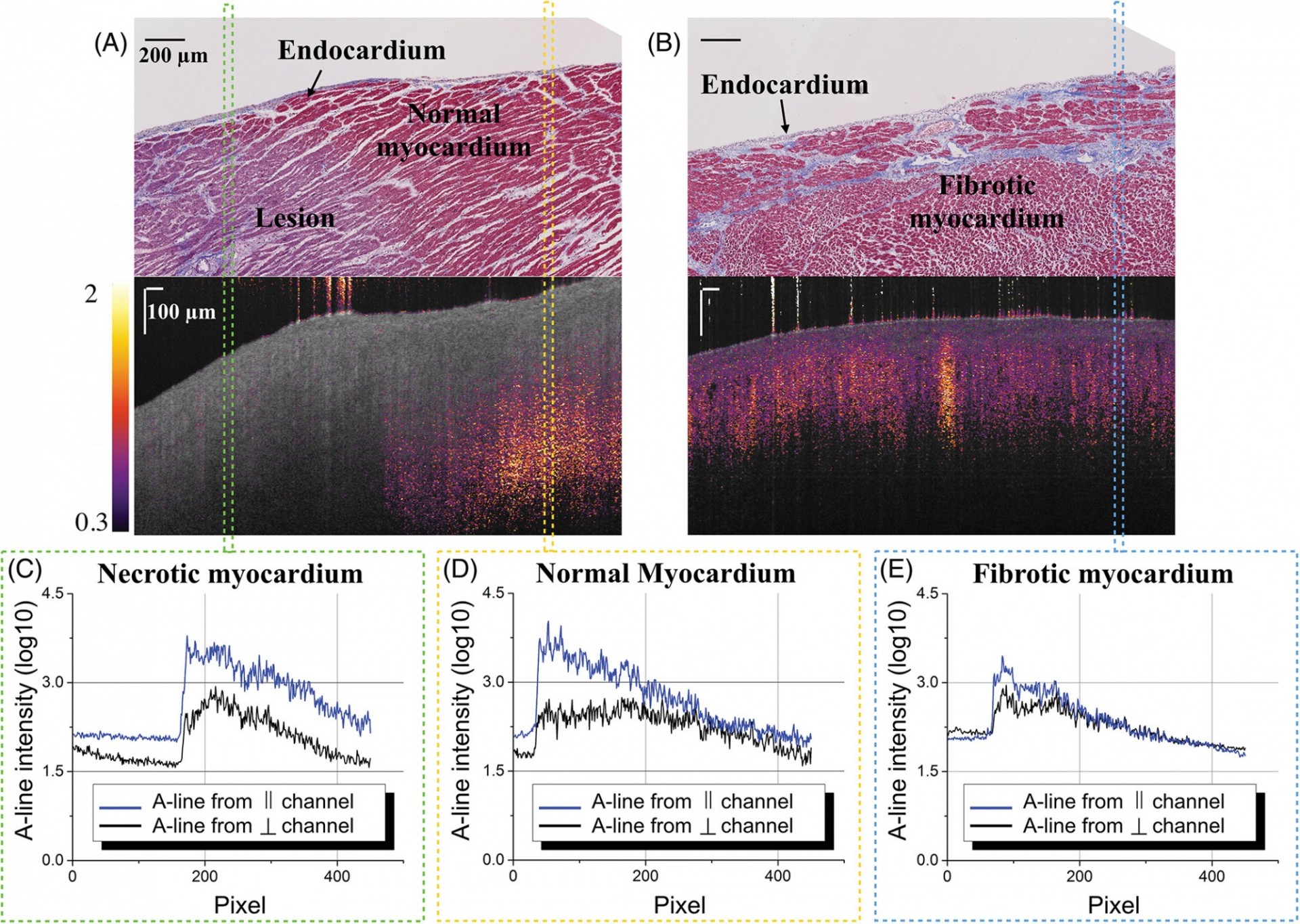 Multi-contrast Endomyocardial Imaging By Single-channel High Resolution Cross-polarization Optical Coherence Tomography