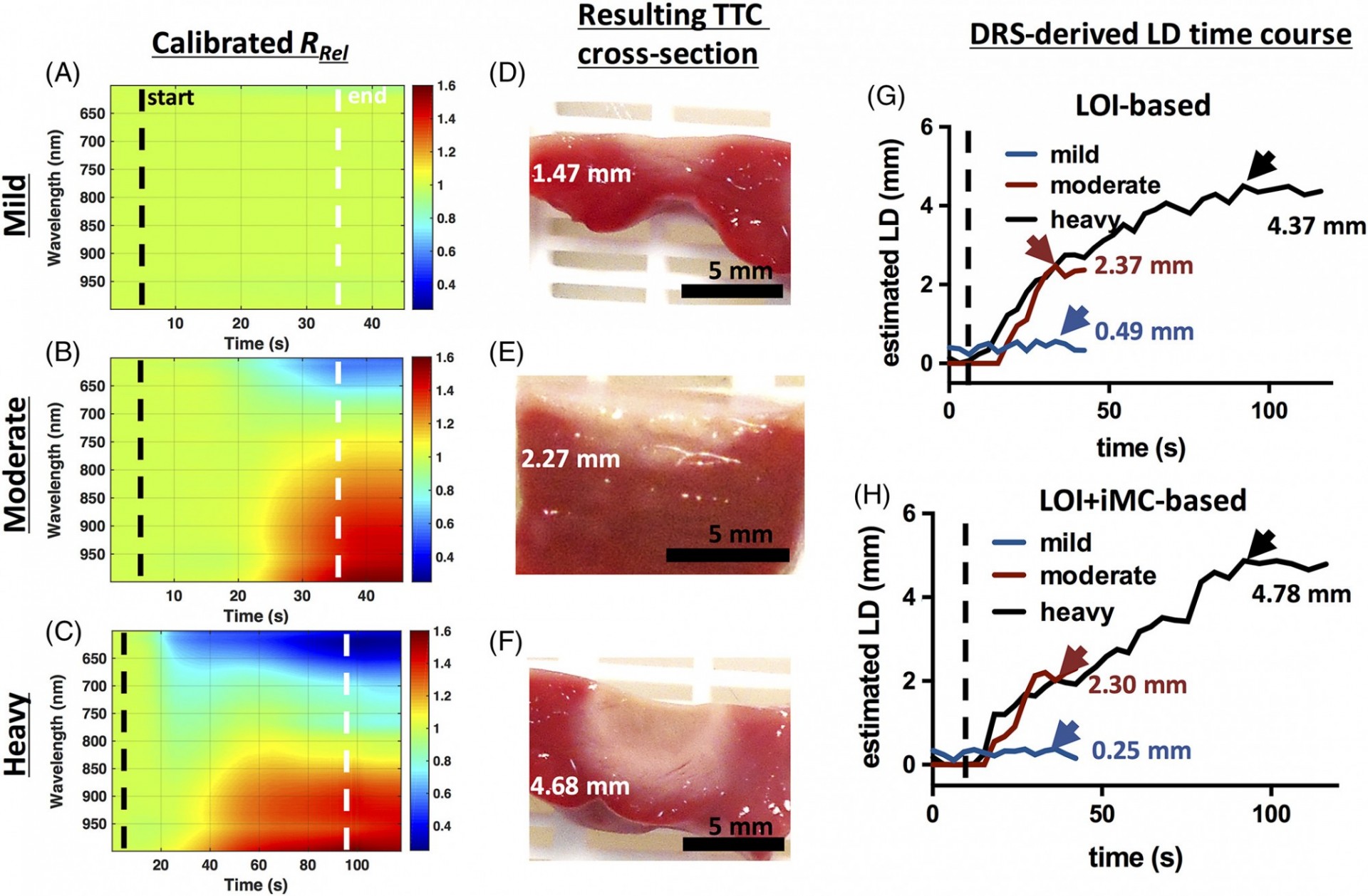 Real time tracking of lesion formation using an integrated RFA and NIRS catheter