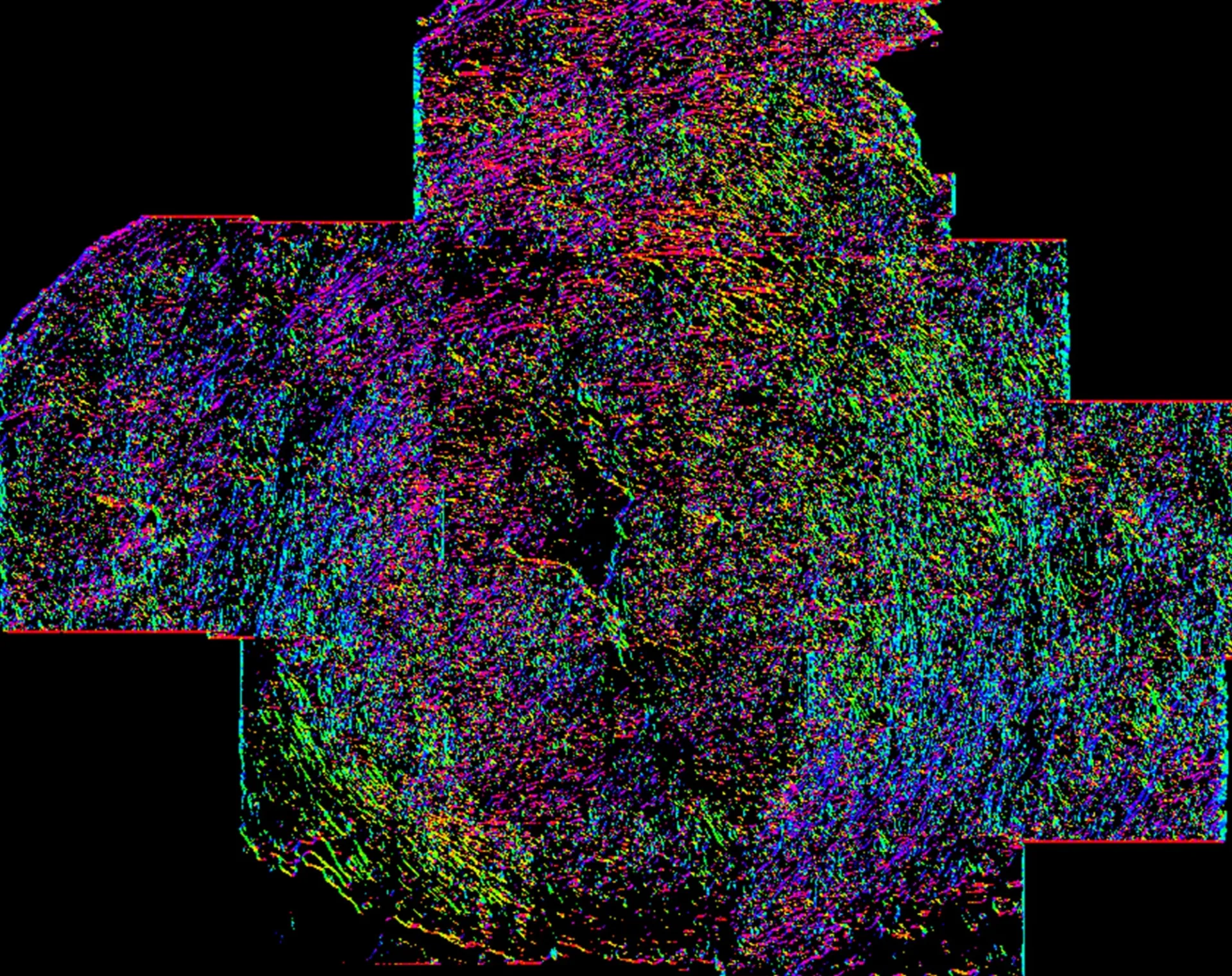 Pixel wise fiber orientation algorithm used to characterize cervical architecture within OCT images